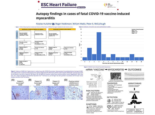 autopsy findings myorcarditis autopsy findings myorcarditis