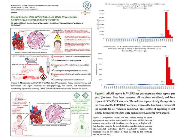 myorcarditas aftter sars cov2 myorcarditas aftter sars cov2